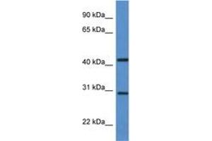 Image no. 1 for anti-Alkaline Ceramidase 1 (ACER1) (C-Term) antibody (ABIN6746914) (ACER1 Antikörper  (C-Term))