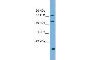 WB Suggested Anti-DNAJA2 Antibody Titration: 0. (DNAJA2 Antikörper  (N-Term))