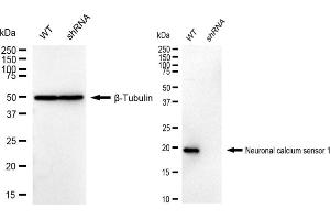 Western blotting analysis using Neuronal calcium sensor 1 antibody (ABIN7799584).
