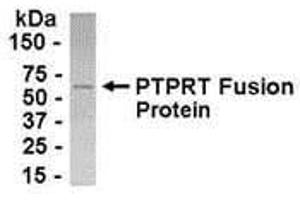 Western Blotting (WB) image for anti-Protein tyrosine Phosphatase, Non-Receptor Type 1 (PTPN1) (AA 288-364) antibody (ABIN2468000)