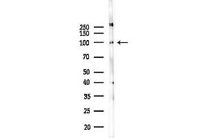 Western blot analysis of lysates from PC12 cells(LPS 4h treatment), using PDE4D Antibody at 1/1000 dilution.