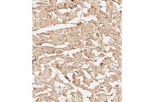 Immunohistochemical analysis of paraffin-embedded Human heart tissue using A performed on the Leica® BOND RXm. (COL5A1 Antikörper  (N-Term))