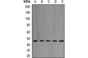 Western blot analysis of eIF4A1 expression in Hela (A), Jurkat (B), NIH3T3 (C), PC12 (D), mouse liver (E) whole cell lysates. (EIF4A1 Antikörper)