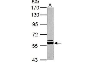 Western Blotting (WB) image for anti-Pyruvate Kinase (PK) (Center) antibody (ABIN2856815)