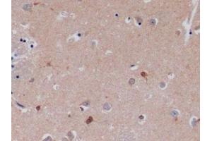 Detection of SCFR in Human Cerebrum Tissue using Polyclonal Antibody to Stem Cell Factor Receptor (SCFR)