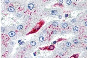 Human Liver, Kupffer Cells (formalin-fixed, paraffin-embedded) stained with CD74 antibody ABIN239807 at 10 µg/ml followed by biotinylated anti-mouse IgG secondary antibody ABIN481714, alkaline phosphatase-streptavidin and chromogen. (CD74 Antikörper)