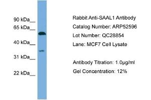 WB Suggested Anti-SAAL1  Antibody Titration: 0.