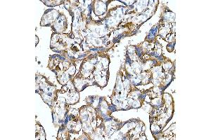 Immunohistochemistry (IHC) image for anti-Folate Receptor 1 (Adult) (FOLR1) antibody (ABIN7267223)