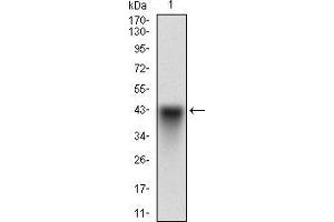 Western blot analysis using SYCP3 mAb against human SYCP3 recombinant protein. (SYCP3 Antikörper  (AA 27-128))
