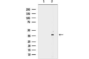 anti-Carcinoembryonic Antigen-Related Cell Adhesion Molecule 6 (CEACAM6) antibody