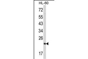 Western blot analysis of RAN Antibody (N-term) (ABIN390647 and ABIN2840945) in HL-60 cell line lysates (35 μg/lane). (RAN Antikörper  (N-Term))