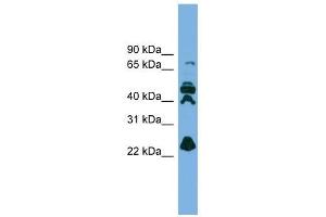 RPE antibody used at 1 ug/ml to detect target protein.