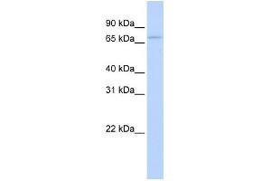 WB Suggested Anti-RBM35B Antibody Titration:  0. (ESRP2 Antikörper  (N-Term))