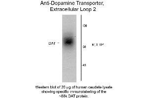 Western Blot of Anti-Dopamine Transporter (Rabbit) Antibody - 600-401-D30 Western Blot of Rabbit Anti-Dopamine Transporter C-Terminus Human Antibody. (SLC6A3 Antikörper  (Extracellular Loop))