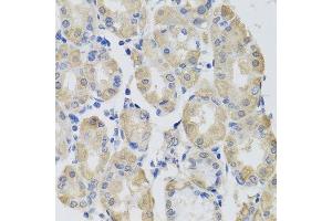 Immunohistochemistry of paraffin-embedded human stomach using GPT antibody. (ALT Antikörper  (AA 1-190))