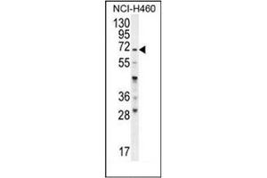 Western blot analysis of FUT4 Antibody (C-term) in NCI-H460 cell line lysates (35ug/lane). (CD15 Antikörper  (C-Term))
