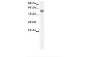 Image no. 1 for anti-Zinc Finger Protein 768 (ZNF768) (AA 57-106) antibody (ABIN202709) (ZNF768 Antikörper  (AA 57-106))
