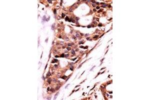 Image no. 2 for anti-Protein Phosphatase 3, Catalytic Subunit, beta Isozyme (PPP3CB) (N-Term) antibody (ABIN360810)