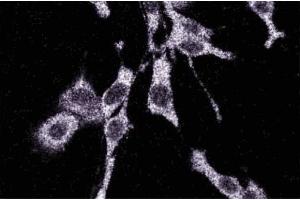 Immunofluorescence staining of RSV-3T3 cells. (MAP3K3 Antikörper  (AA 27-135))