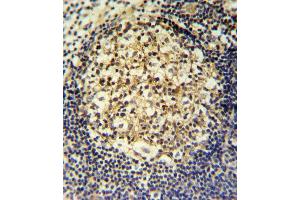 CCR7 Antibody (N-term) (ABIN651190 and ABIN2840119) IHC analysis in formalin fixed and paraffin embedded human tonsil followed by peroxidase conjugation of the secondary antibody and DAB staining. (CCR7 Antikörper  (N-Term))