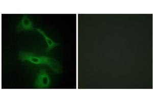 Immunofluorescence analysis of HeLa cells, using CLUS antibody.