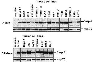 Western Blotting (WB) image for anti-Caspase 2, Apoptosis-Related Cysteine Peptidase (CASP2) antibody (ABIN187544) (Caspase 2 Antikörper)