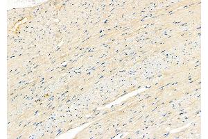 ABIN6266264 and ABIN6277421 at 1/100 staining Rat heart tissue by IHC-P. (PARD6A Antikörper  (N-Term))