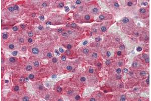 Human Liver: Formalin-Fixed, Paraffin-Embedded (FFPE) (CBS Antikörper  (AA 1-101))