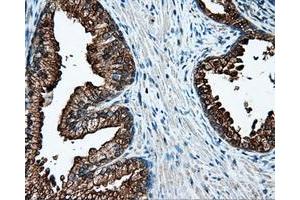 Immunohistochemical staining of paraffin-embedded Kidney tissue using anti-L1CAM mouse monoclonal antibody. (L1CAM Antikörper)