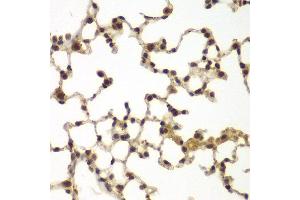 Immunohistochemistry of paraffin-embedded mouse lung using SULT2B1 antibody at dilution of 1:100 (x40 lens). (SULT2B1 Antikörper)