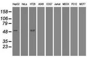 Image no. 6 for anti-serpin Peptidase Inhibitor, Clade A (Alpha-1 Antiproteinase, Antitrypsin), Member 1 (SERPINA1) antibody (ABIN1500874)