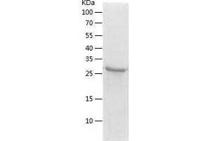 Western Blotting (WB) image for RAB26, Member RAS Oncogene Family (RAB26) (AA 2-256) protein (His tag) (ABIN7124744)