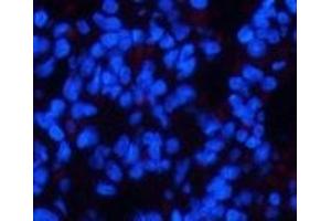 Immunofluorescence analysis of Rat lung tissue using Phospho-CHEK2 (Thr68) Polyclonal Antibody at dilution of 1:200 (CHEK2 Antikörper  (pThr68))