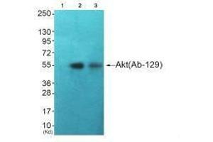 Western blot analysis of extracts from HuvEc cells (Lane 2) and JK cells (Lane 3), using Akt (Ab-129) antiobdy. (AKT1 Antikörper  (Ser129))