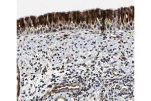 Immunohistochemical staining of human nasopharynx with C12orf35 polyclonal antibody  shows strong nuclear and cytoplasmic positivity in respiratory epithelial cells.