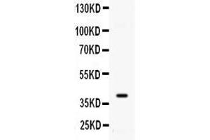 Western blot analysis of ADK using anti- ADK antibody . (ADK Antikörper  (AA 165-351))