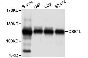 Western blot analysis of extracts of various cell lines, using CSE1L antibody. (Exportin 2 Antikörper  (AA 50-150))