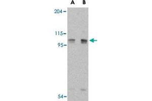 Western blot analysis of AOF2 in P815 cell lysate with AOF2 polyclonal antibody  at (A) 1 and (B) 2 ug/mL . (LSD1 Antikörper  (Internal Region))