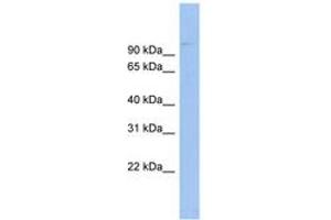 Image no. 1 for anti-ATP-Binding Cassette, Sub-Family B (MDR/TAP), Member 6 (ABCB6) (AA 431-480) antibody (ABIN6744718) (ABCB6 Antikörper  (AA 431-480))