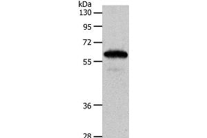 Western Blot analysis of Mouse brain tissue using INA Polyclonal Antibody at dilution of 1:550 (INA Antikörper)