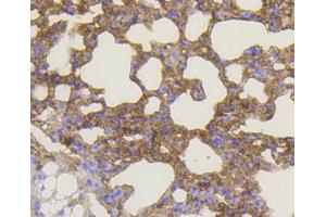 Immunohistochemistry of paraffin-embedded mouse lung using BAK1 antibody (ABIN4903006) at dilution of 1:100 (40x lens).