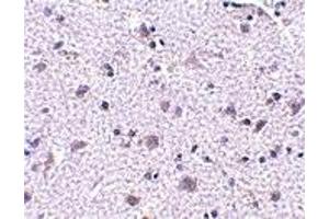 Immunohistochemistry (IHC) image for anti-Cerebral Dopamine Neurotrophic Factor (CDNF) (N-Term) antibody (ABIN1031315) (CDNF Antikörper  (N-Term))