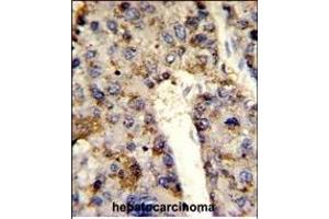 Immunohistochemistry (Paraffin-embedded Sections) (IHC (p)) image for anti-Heterogeneous Nuclear Ribonucleoprotein L (HNRNPL) (AA 249-277) antibody (ABIN650774)