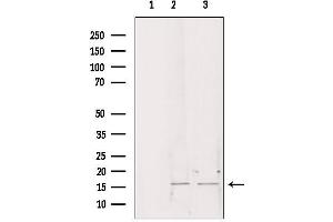 Western blot analysis of extracts from various samples, using CHCHD2 antibody. (CHCHD2 Antikörper  (Internal Region))