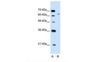 Image no. 2 for anti-Cystathionine-beta-Synthase (CBS) (AA 164-213) antibody (ABIN320982)