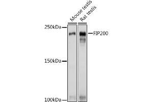 Western blot analysis of extracts of various cell lines, using FIP200 Rabbit pAb (ABIN7269881) at 1:1000 dilution. (FIP200 Antikörper  (C-Term))