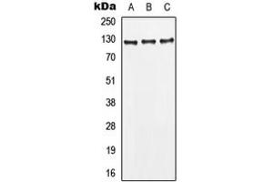 Western blot analysis of CD295 expression in MCF7 (A), HepG2 (B), HeLa (C) whole cell lysates. (Leptin Receptor Antikörper  (Center))
