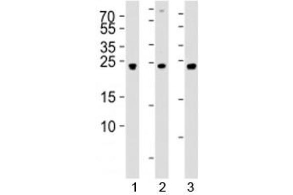 UCHL3 Antikörper  (AA 195-225)