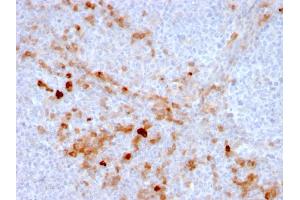 Immunohistochemistry (IHC) image for anti-Endoglin (ENG) (AA 74-251) antibody (ABIN6939307)