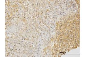 Image no. 1 for anti-Dihydropyrimidinase-Like 3 (DPYSL3) (AA 457-556) antibody (ABIN598653) (DPYSL3 Antikörper  (AA 457-556))